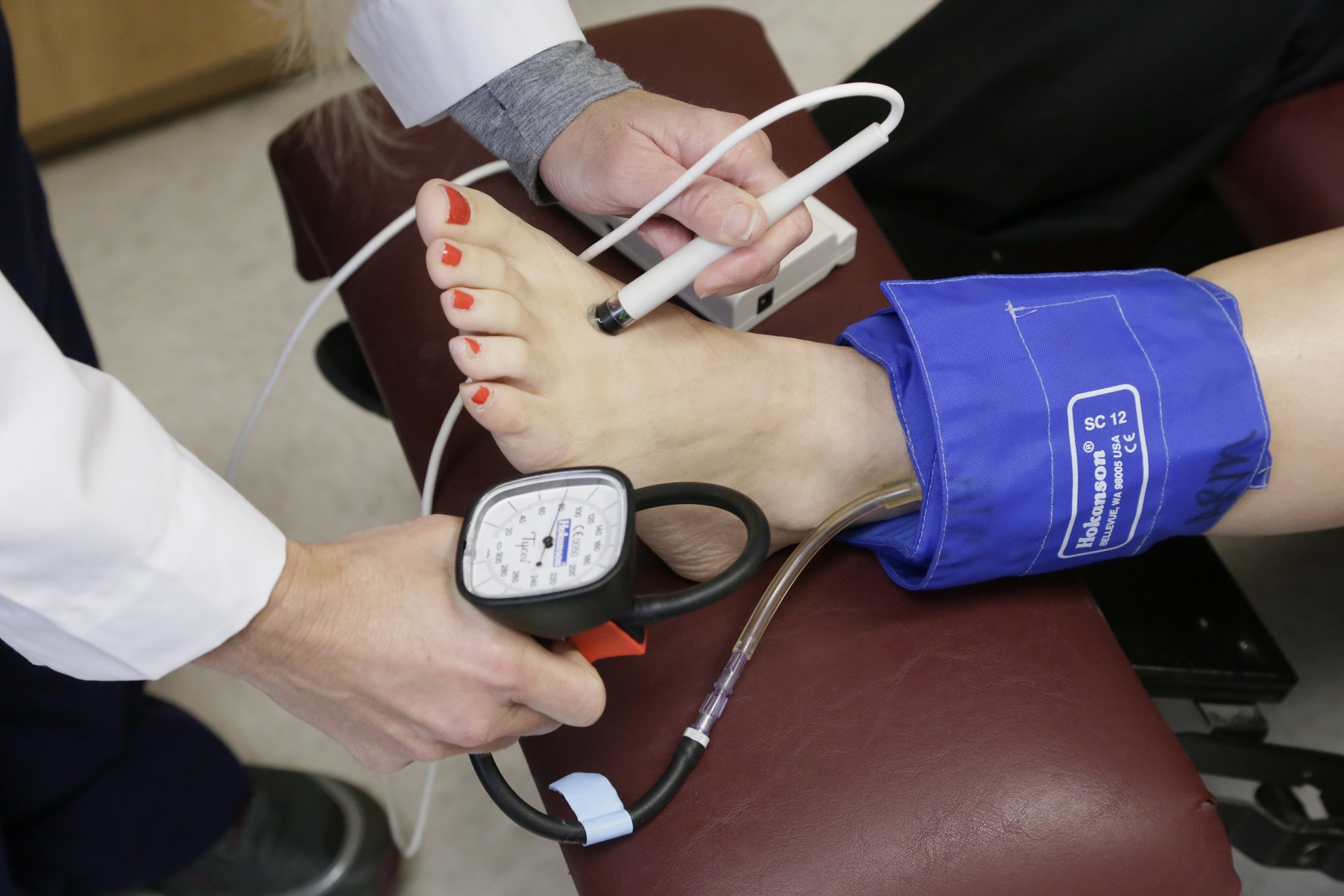 Ankle Brachial Index Measurement and Result New Health Advisor